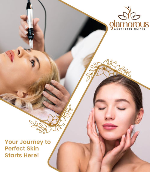 Microneedling in Islamabad Glam Aesthetics