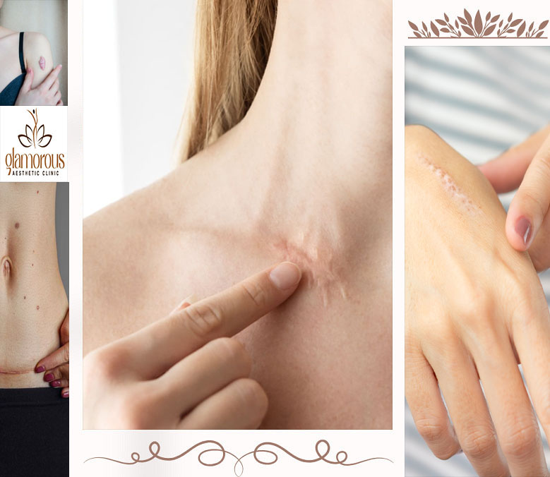 Surgical Scar Revision Clinic in Islamabad Cost & Price Glam Aesthetics Islamabad