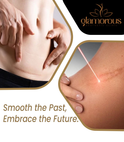 Surgical Scar Revision Treatment Cost in Islamabad Pakistan