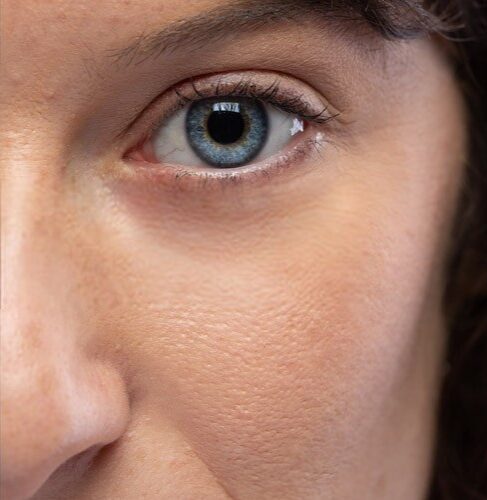 Botox Injections in Islamabad Pakistan Cost