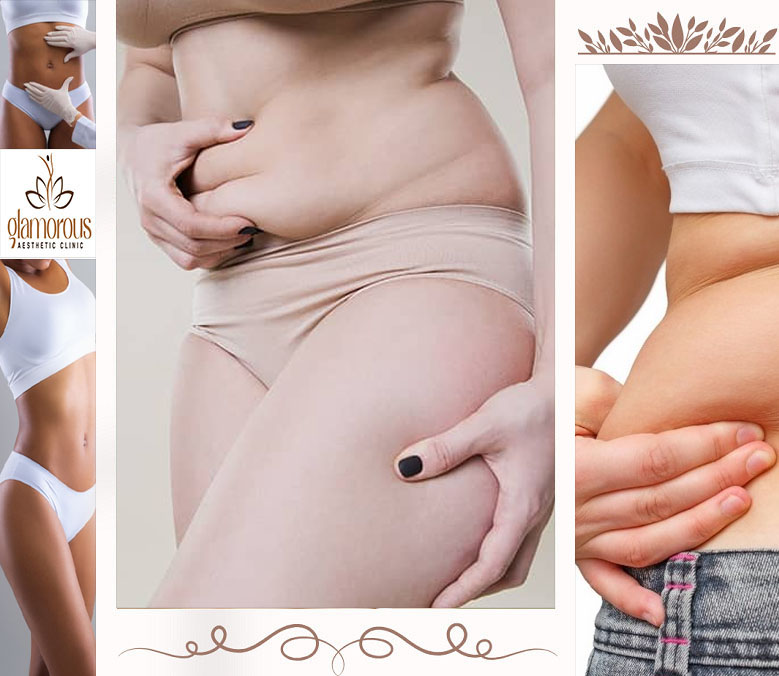 Liposuction In Islamabad Pakistan Glam Aesthetics