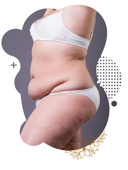 Liposuction in Islamabad Pakistan Cost & Deals