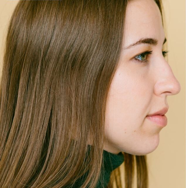 Rhinoplasty Cost in Islamabad Glam Aesthetics