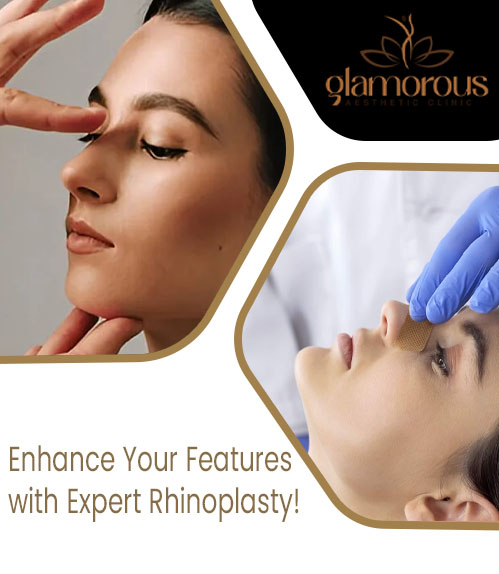 Rhinoplasty In Islamabad Pakistan