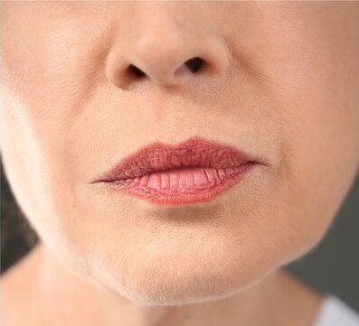 Ultherapy Treatment in Islamabad Glam Aesthetics