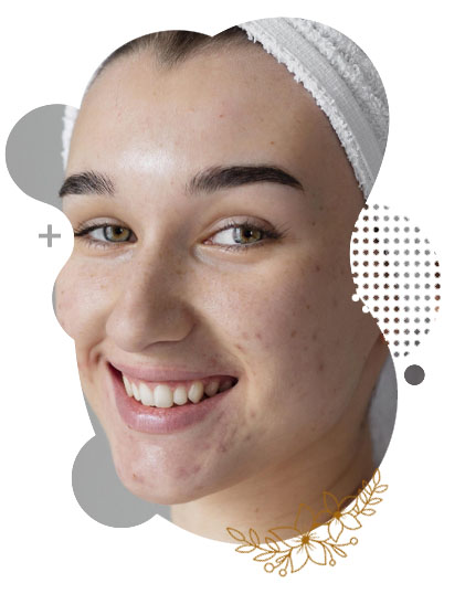 Best Facial Scar Revision in Islamabad