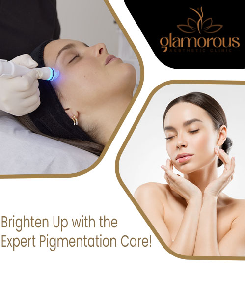 Best Pigmentation Treatment in Islamabad Pakistan