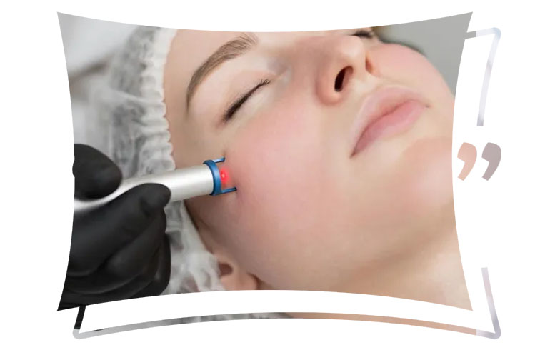 Facial Scar Revision in Islamabad Deals