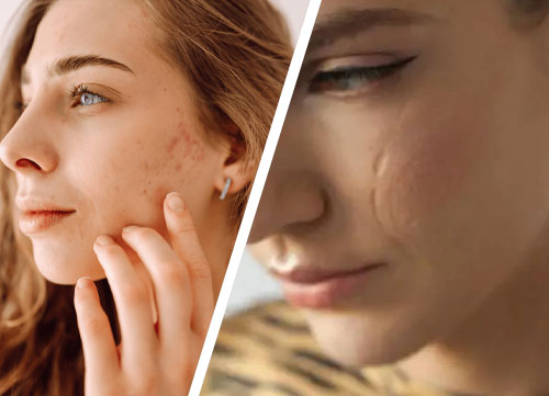 Facial Scar Revision in Islamabad Pakistan