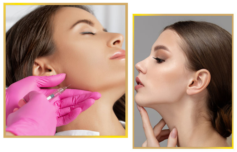 Jawline Fillers Injections in Islamabad Pakistan