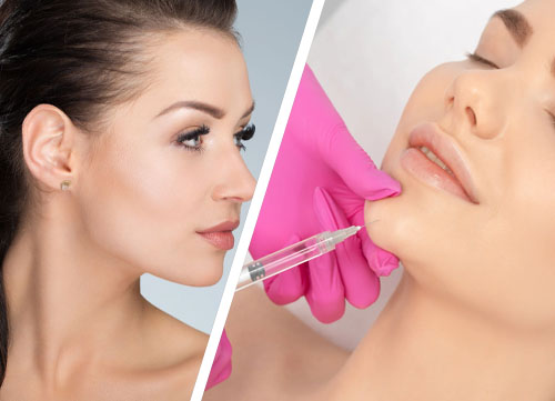 Jawline Fillers Injections in Islamabad