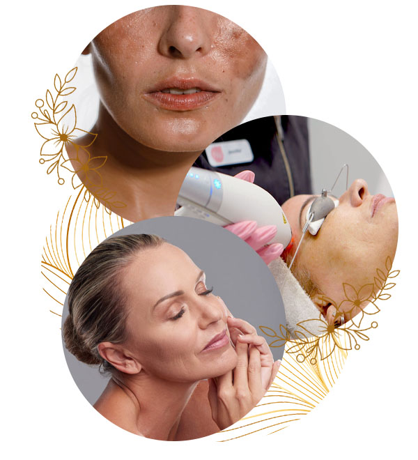 Pigmentation Treatment Cost in Islamabad