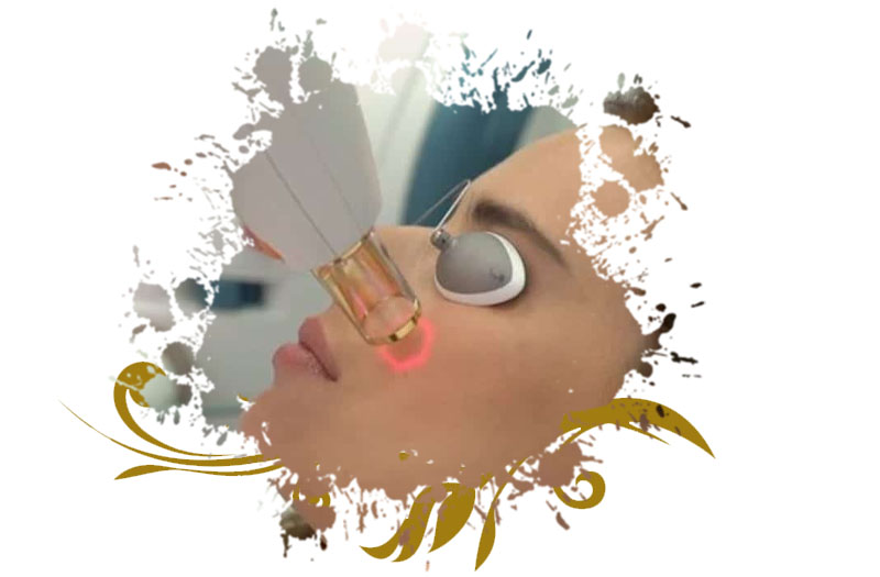 Pigmentation Treatment in Islamabad Cost