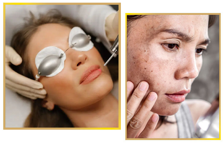Pigmentation Treatment in Islamabad Pakistan