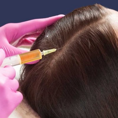 PRF Hair Treatment in Islamabad