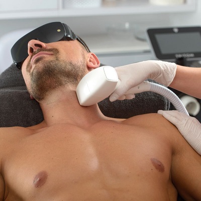 Laser Hair Removal For Men in Islamabad
