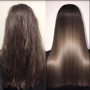 Nanoplastia Hair Treatment Before & After clinic islamabad