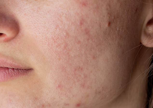 transformation-img-1.jpg transformation-img-1.jpg