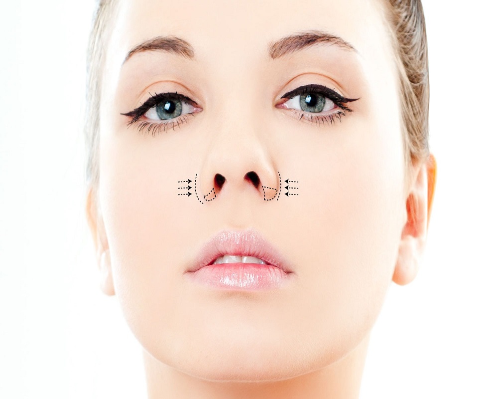 Alarplasty in Islamabad Pakistan