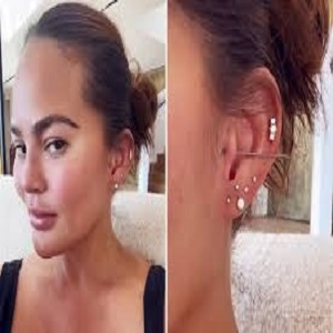 Ear Piercing Before & After clinic in Islamabad