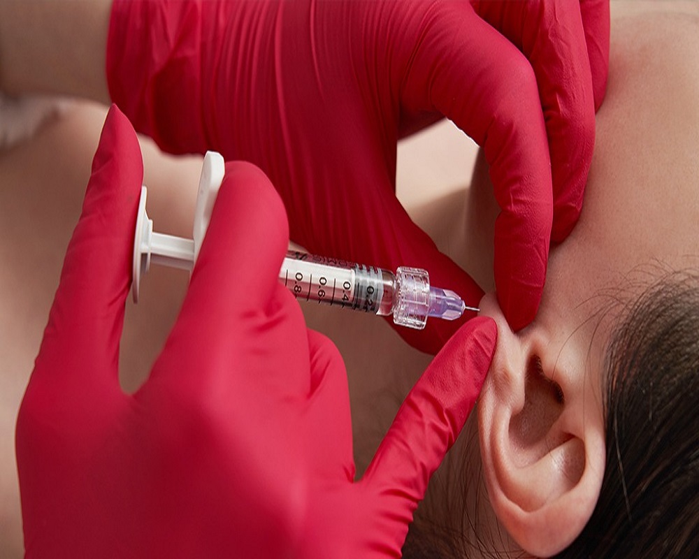 Earlobe Correction Surgery in Islambad Pakistan