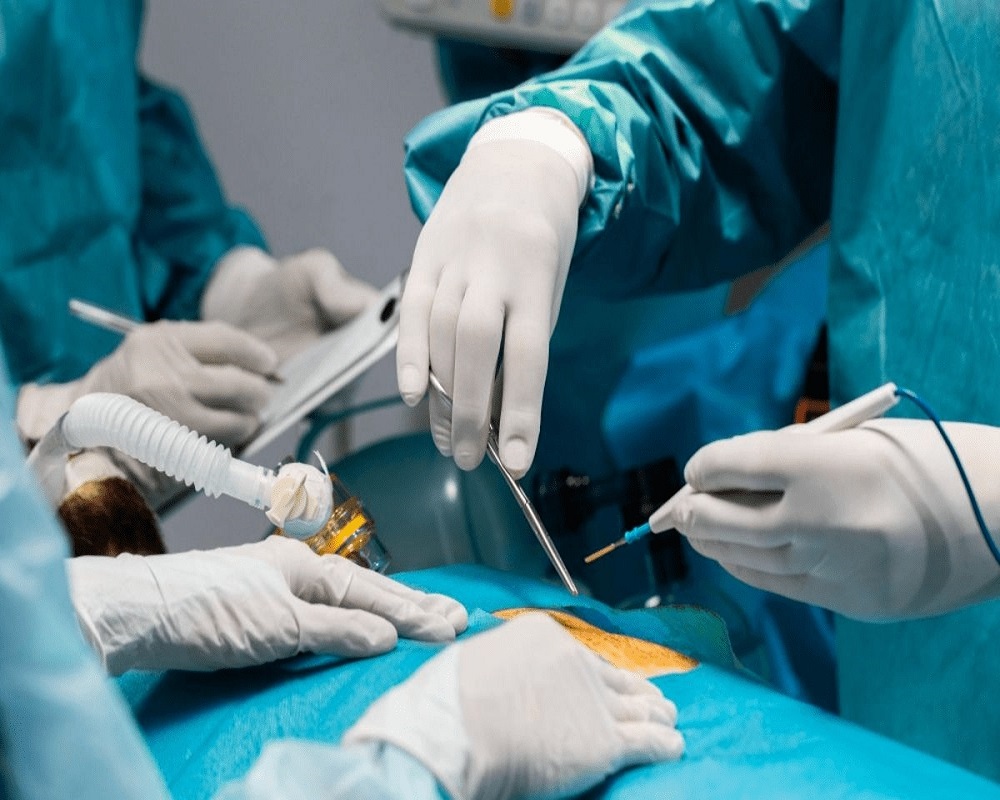 Fistula Surgery in Islamabad Pakistan