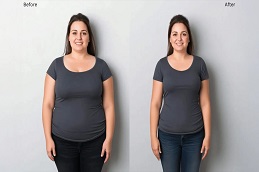 Mounjaro Before & After Clinic in Lahore