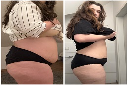 Mounjaro Before & After in Lahore