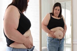 Mounjaro Before & After