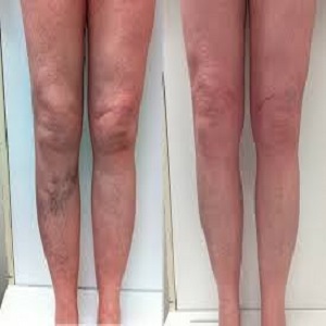 Vascular Surgery Before & After clinic in Islamabad