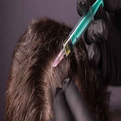 Best Exosomes Hair Treatment in Islamabad