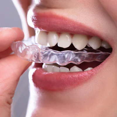 Braces Price in Pakistan