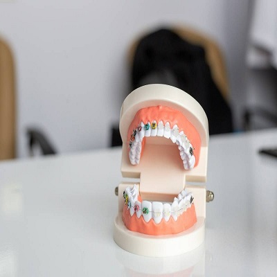 Best Orthodontists in Islamabad