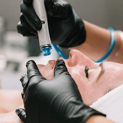 Hydrafacial Vs Chemical Peel — Which Is Better?