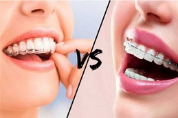 Results of Orthodontists Clinic in Islamabad