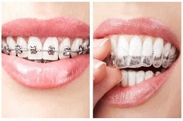 Results of Orthodontists Islamabad