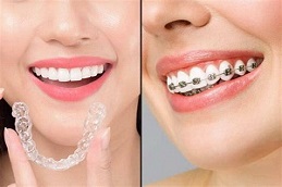 Results of Orthodontists in Islamabad