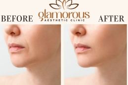 Before and After Facelift in Islamabad , Pakistan