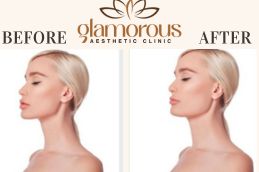 Before and After Facelift surgery in Islamabad Rawalpindi