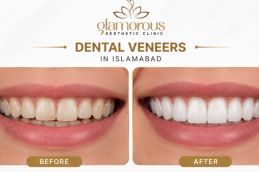 Dentistry before and After Result