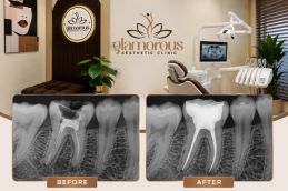 Dentistry before in Islamabad