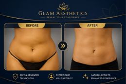 Before and After Result of Lipomatic Treatment