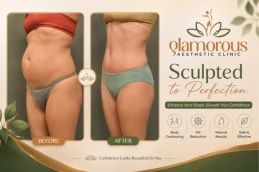 Before and After Results of Lipomatic Treatment in Islamabad