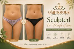 Before and After Results of Lipomatic Treatment in Islamabad (1)