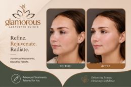 Fore head Lift result in Islamabad Rawalpindi Pakistan