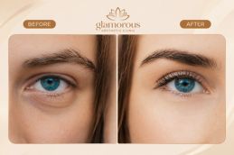 Fox Eye Surgery before and after Rawalpindi Pakistan