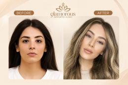 Fox Eye Surgery before and after in Islamabad