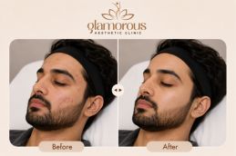 Hydrafacial Results in Islamabad Pakistan