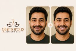 before and after results dental implant