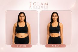 Cost of Body Contouring in Islamabad depends on Result of treatment